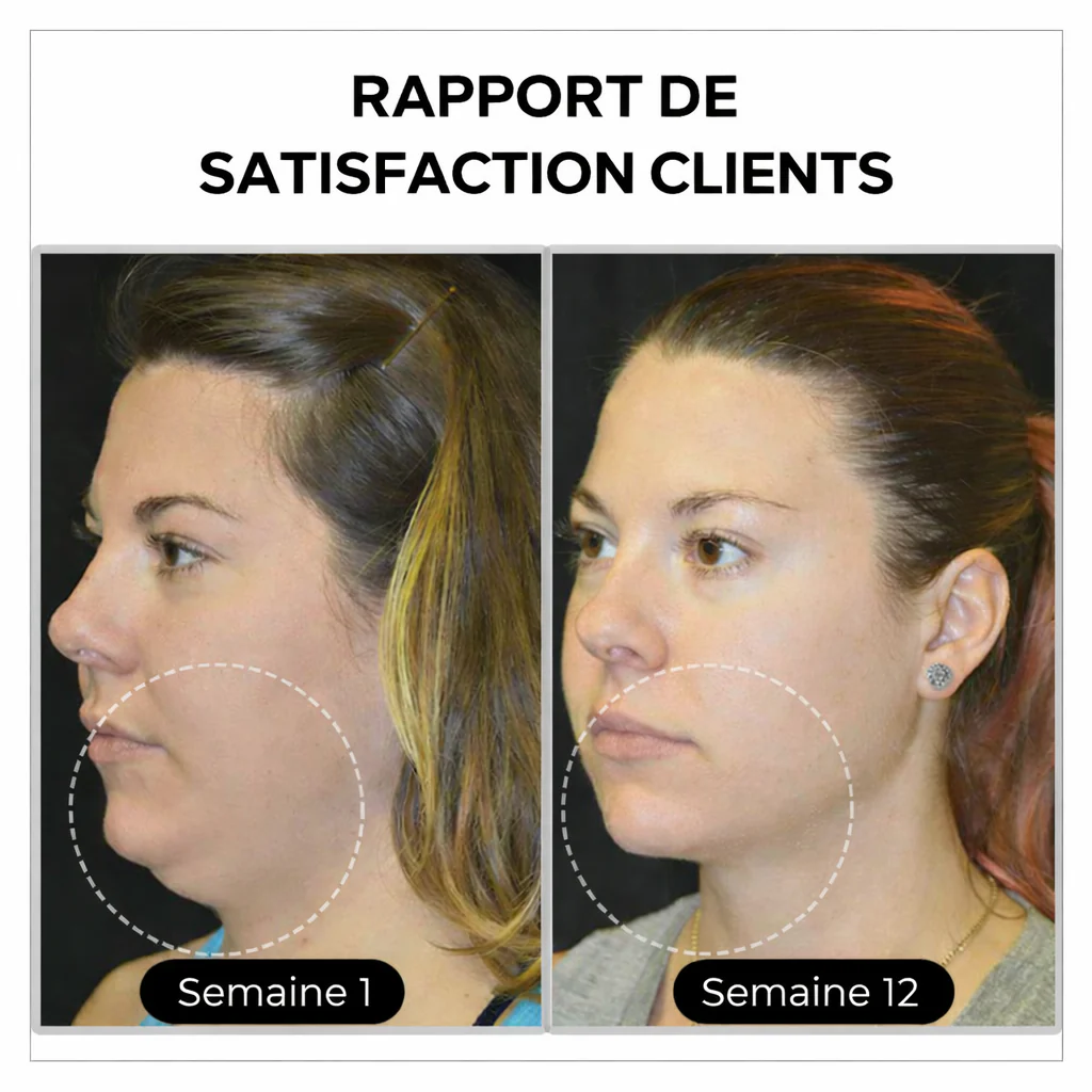 (đ DERNIER JOUR â SOLDES 80%)đ CZTICLEÂź Histone Magnetology Lymphvity Boucles dâOreilles en Germanium - Image 3