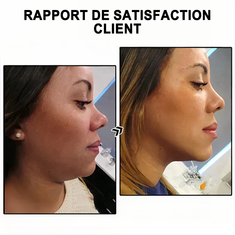 đ„đđđđđđđÂź Lymphvity MagneTherapy Boucles d'oreilles en Germaniumđ (PortĂ©es une fois par jour, changements visibles en 7 jours) Soutien contre le surpoids, le diabĂšte, l'apnĂ©e du sommeil et les douleurs articulaires đ - Image 4