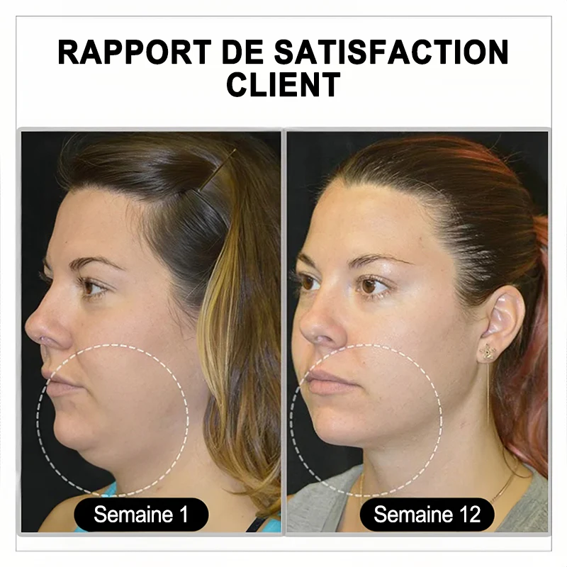 đ„đđđđđđđÂź Lymphvity MagneTherapy Boucles d'oreilles en Germaniumđ (PortĂ©es une fois par jour, changements visibles en 7 jours) Soutien contre le surpoids, le diabĂšte, l'apnĂ©e du sommeil et les douleurs articulaires đ - Image 7